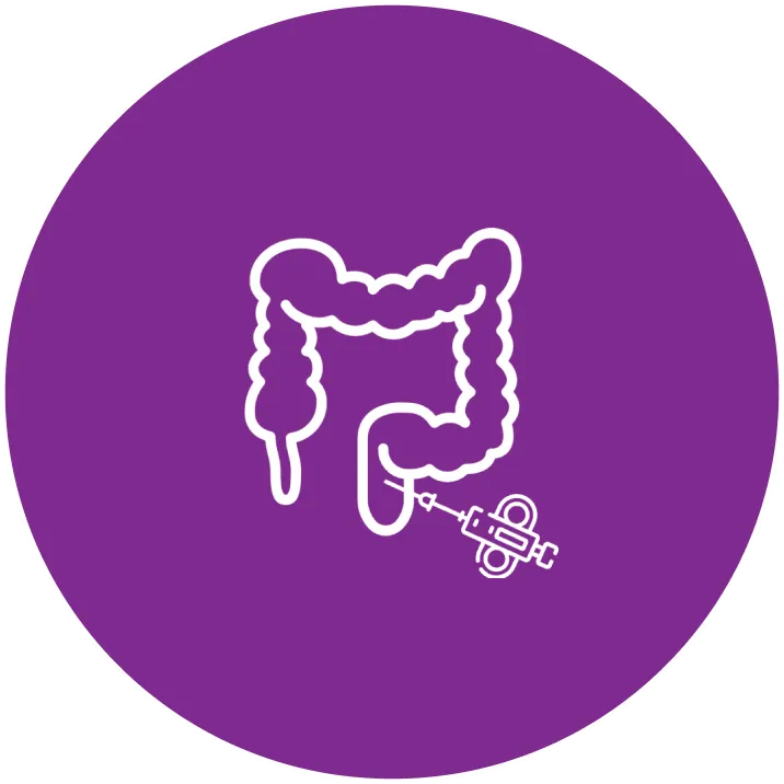 Rectum Cancer